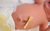 Những bất thường ở rốn trẻ sơ sinh cảnh báo bệnh nguy hiểm, cha mẹ cần phải biết Những bất thường ở rốn trẻ sơ sinh cảnh báo bệnh nguy hiểm, cha mẹ cần phải biết