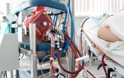 Bác gái BN17 hiện ra sao sau khi bất ngờ diễn biến nặng trở lại mấy ngày trước? Bác gái BN17 hiện ra sao sau khi bất ngờ diễn biến nặng trở lại mấy ngày trước?