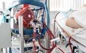 BN416 ở Đà Nẵng nguy cơ tử vong cao, BN418 còn nặng hơn, xem xét đặt ECMO BN416 ở Đà Nẵng nguy cơ tử vong cao, BN418 còn nặng hơn, xem xét đặt ECMO