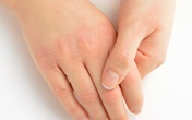 10 dấu hiệu cơ thể bạn đang mang trọng bệnh hoặc sức khỏe tụt dốc 10 dấu hiệu cơ thể bạn đang mang trọng bệnh hoặc sức khỏe tụt dốc