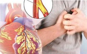 Bệnh nhân tim mạch cần lưu ý những điều này để sống khoẻ trong đại dịch COVID-19 Bệnh nhân tim mạch cần lưu ý những điều này để sống khoẻ trong đại dịch COVID-19