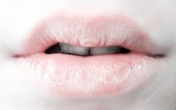 Có 7 dấu hiệu bất thường trên môi cảnh báo sức khỏe không tốt, mọi người nên đi khám ngay Có 7 dấu hiệu bất thường trên môi cảnh báo sức khỏe không tốt, mọi người nên đi khám ngay
