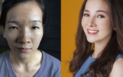 Cô gái bị bạn trai bỏ vì 'mắt lươn' kết hôn sau 3 năm dao kéo mặt Cô gái bị bạn trai bỏ vì 'mắt lươn' kết hôn sau 3 năm dao kéo mặt