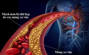 Bí quyết 2 trong 1 vừa giảm đường huyết vừa giảm mỡ máu từ nghiên cứu quốc tế Bí quyết 2 trong 1 vừa giảm đường huyết vừa giảm mỡ máu từ nghiên cứu quốc tế