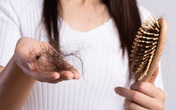 Chị em đừng dại mà động vào các loại thực phẩm này nhiều nếu không chẳng mấy chốc mà hói đầu Chị em đừng dại mà động vào các loại thực phẩm này nhiều nếu không chẳng mấy chốc mà hói đầu