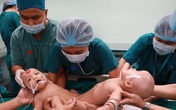 Sáng nay mổ tách đôi song sinh dính nhau hiếm gặp Sáng nay mổ tách đôi song sinh dính nhau hiếm gặp