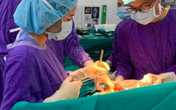Tiết lộ bất ngờ về nguyên nhân ung thư gan, từ món ăn hàng triệu người Việt ưa thích Tiết lộ bất ngờ về nguyên nhân ung thư gan, từ món ăn hàng triệu người Việt ưa thích