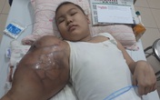 Cánh tay của cô bé dân tộc Tày mắc ung thư xương hoại tử, không thể thực hiện phẫu thuật