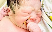 Lưu ý khi sử dụng vòng tránh thai chị em cần nhớ Lưu ý khi sử dụng vòng tránh thai chị em cần nhớ