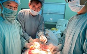Lấy lưỡi câu và dây cước dài 40cm trong ruột nữ bệnh nhân Lấy lưỡi câu và dây cước dài 40cm trong ruột nữ bệnh nhân