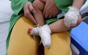 Bé trai bỏng nặng bộ phận sinh dục vì ngã vào nồi canh Bé trai bỏng nặng bộ phận sinh dục vì ngã vào nồi canh