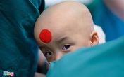 Thưởng ê-kíp phẫu thuật cặp song sinh dính liền Thưởng ê-kíp phẫu thuật cặp song sinh dính liền