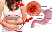 Trước và sau khi ngủ không làm điều này bạn sẽ đối diện nguy cơ ung thư dạ dày và cổ họng cực cao Trước và sau khi ngủ không làm điều này bạn sẽ đối diện nguy cơ ung thư dạ dày và cổ họng cực cao