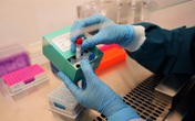Vinmec phát triển thành công 02 bộ kit phát hiện và chẩn đoán virus Sars-Cov-2 Vinmec phát triển thành công 02 bộ kit phát hiện và chẩn đoán virus Sars-Cov-2