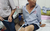 Khởi tố 2 đối tượng dùng dao chém công an nhập viện Khởi tố 2 đối tượng dùng dao chém công an nhập viện
