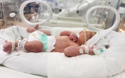 Sản phụ sinh con khỏe mạnh dù đã vỡ tử cung ở tuần 25 và những kỳ tích tưởng như “khó có thể xảy ra” Sản phụ sinh con khỏe mạnh dù đã vỡ tử cung ở tuần 25 và những kỳ tích tưởng như “khó có thể xảy ra”