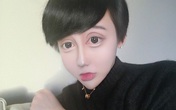 Xuất hiện trở lại sau 3 tháng mất tích, "chàng trai mặt rắn" tiết lộ muốn chết ngay vì biến chứng hậu 50 lần dao kéo Xuất hiện trở lại sau 3 tháng mất tích, "chàng trai mặt rắn" tiết lộ muốn chết ngay vì biến chứng hậu 50 lần dao kéo