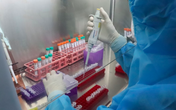 Đã có kết quả giải trình tự gene virus SARS-CoV-2 ở ổ dịch Chí Linh, Vân Đồn Đã có kết quả giải trình tự gene virus SARS-CoV-2 ở ổ dịch Chí Linh, Vân Đồn
