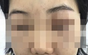 Hai phụ nữ nhập viện sau khi tiêm tế bào gốc Hai phụ nữ nhập viện sau khi tiêm tế bào gốc