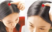 Cơ thể con người có 5 "công tắc" để mọc tóc, hãy bấm mỗi ngày để ngăn rụng tóc và tạm biệt hói đầu Cơ thể con người có 5 "công tắc" để mọc tóc, hãy bấm mỗi ngày để ngăn rụng tóc và tạm biệt hói đầu