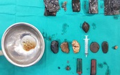 Hà Nội: Tìm thấy bật lửa, dao lam, túi nilon... trong bụng người đàn ông "ăn mọi thứ" Hà Nội: Tìm thấy bật lửa, dao lam, túi nilon... trong bụng người đàn ông "ăn mọi thứ"