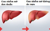 Bé trai mới 8 tuổi đã phát hiện bị gan nhiễm mỡ Bé trai mới 8 tuổi đã phát hiện bị gan nhiễm mỡ
