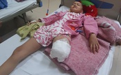 Cô bé mắc ung thư xương Phương Chi đã phải cắt một bên chân
