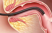Bác sĩ khuyến cáo: Những dấu hiệu cảnh báo có thể là ung thư, nên chú ý đi khám sớm Bác sĩ khuyến cáo: Những dấu hiệu cảnh báo có thể là ung thư, nên chú ý đi khám sớm