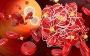 Uống nước vào 4 thời điểm này còn tốt hơn trăm viên thuốc bổ, ngăn ngừa tắc mạch máu Uống nước vào 4 thời điểm này còn tốt hơn trăm viên thuốc bổ, ngăn ngừa tắc mạch máu