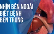 BS hướng dẫn cách "nhìn ngoài thấy trong" để xem bạn đang khỏe hay có bệnh: Rất hữu ích BS hướng dẫn cách "nhìn ngoài thấy trong" để xem bạn đang khỏe hay có bệnh: Rất hữu ích