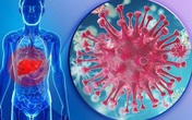 Virus nào gây viêm gan? Virus nào gây viêm gan?