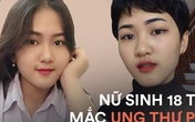 Nữ sinh 18 tuổi mắc ung thư phổi: "Một ngày đứng trước gương, chỉ vuốt tóc 15 phút nhưng mình trọc cả mái đầu" Nữ sinh 18 tuổi mắc ung thư phổi: "Một ngày đứng trước gương, chỉ vuốt tóc 15 phút nhưng mình trọc cả mái đầu"
