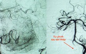 Cứu sống bệnh nhân hai lần ngưng tim Cứu sống bệnh nhân hai lần ngưng tim