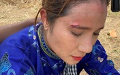 Đồng nghiệp thương xót “bà mối” Cát Tường bị thương trên trường quay Đồng nghiệp thương xót “bà mối” Cát Tường bị thương trên trường quay