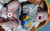 Xót xa bé gái toàn thân lở loét khóc ngằn ngặt trong ngày đông lạnh mà không tiền điều trị Xót xa bé gái toàn thân lở loét khóc ngằn ngặt trong ngày đông lạnh mà không tiền điều trị