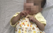 Căn bệnh khiến bé trai 7 tháng tuổi nhỏ như trẻ sơ sinh Căn bệnh khiến bé trai 7 tháng tuổi nhỏ như trẻ sơ sinh