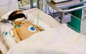 Bé sơ sinh bị chảy máu não Bé sơ sinh bị chảy máu não