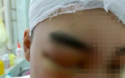 Vụ nam sinh lớp 11 bị bạn cùng trường dùng gậy sắt đánh vỡ sọ não: Hé lộ nguyên nhân ban đầu