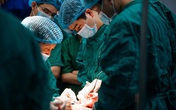 Khối u khổng lồ "ăn sâu" vào xương vùng mặt người phụ nữ nghèo Khối u khổng lồ "ăn sâu" vào xương vùng mặt người phụ nữ nghèo