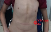 Bé trai 11 tuổi cao 1,8 m Bé trai 11 tuổi cao 1,8 m