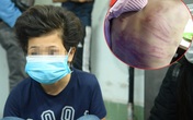 Hà Nội yêu cầu khẩn trương làm rõ vụ bé gái 12 tuổi ở Hà Đông nghi bị mẹ đẻ bạo hành dã man Hà Nội yêu cầu khẩn trương làm rõ vụ bé gái 12 tuổi ở Hà Đông nghi bị mẹ đẻ bạo hành dã man