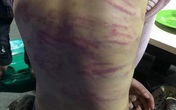 Từ vụ bé gái 12 tuổi bị người tình của mẹ xâm hại: Lý giải nguyên nhân những trẻ em bị xâm hại tình dục thường rơi vào gia đình không yên ấm Từ vụ bé gái 12 tuổi bị người tình của mẹ xâm hại: Lý giải nguyên nhân những trẻ em bị xâm hại tình dục thường rơi vào gia đình không yên ấm