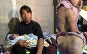 Trần tình của bà mẹ nhẫn tâm bạo hành con gái 12 tuổi ở Hà Nội Trần tình của bà mẹ nhẫn tâm bạo hành con gái 12 tuổi ở Hà Nội
