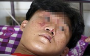 Nhóm người lạ vào tận trường lôi học sinh ra ngoài đánh dã man Nhóm người lạ vào tận trường lôi học sinh ra ngoài đánh dã man