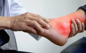 Bệnh lý đặc biệt sau Tết hay gặp dễ nhầm với bệnh lý xương khớp, chủ quan có thể dẫn tới tàn phế Bệnh lý đặc biệt sau Tết hay gặp dễ nhầm với bệnh lý xương khớp, chủ quan có thể dẫn tới tàn phế