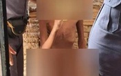 Bé 11 tuổi bị bố và mẹ kế xích ở ban công Bé 11 tuổi bị bố và mẹ kế xích ở ban công