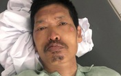 Hà Nội: Bị TNGT nguy kịch, người đàn ông được bác sĩ cứu sống nhưng 10 ngày chưa có người thân đến nhận Hà Nội: Bị TNGT nguy kịch, người đàn ông được bác sĩ cứu sống nhưng 10 ngày chưa có người thân đến nhận