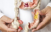 Rượu và một số sự thật khiến bạn kinh ngạc Rượu và một số sự thật khiến bạn kinh ngạc