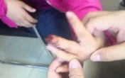 Cha mẹ chủ quan dễ khiến trẻ mất chức năng cầm nắm Cha mẹ chủ quan dễ khiến trẻ mất chức năng cầm nắm