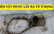 TP.HCM: Bé trai 6 tuổi nôn ói dữ dội, bố mẹ đưa đi cấp cứu thì phát hiện chuỗi hạt kim loại và nam châm gây thủng ruột TP.HCM: Bé trai 6 tuổi nôn ói dữ dội, bố mẹ đưa đi cấp cứu thì phát hiện chuỗi hạt kim loại và nam châm gây thủng ruột